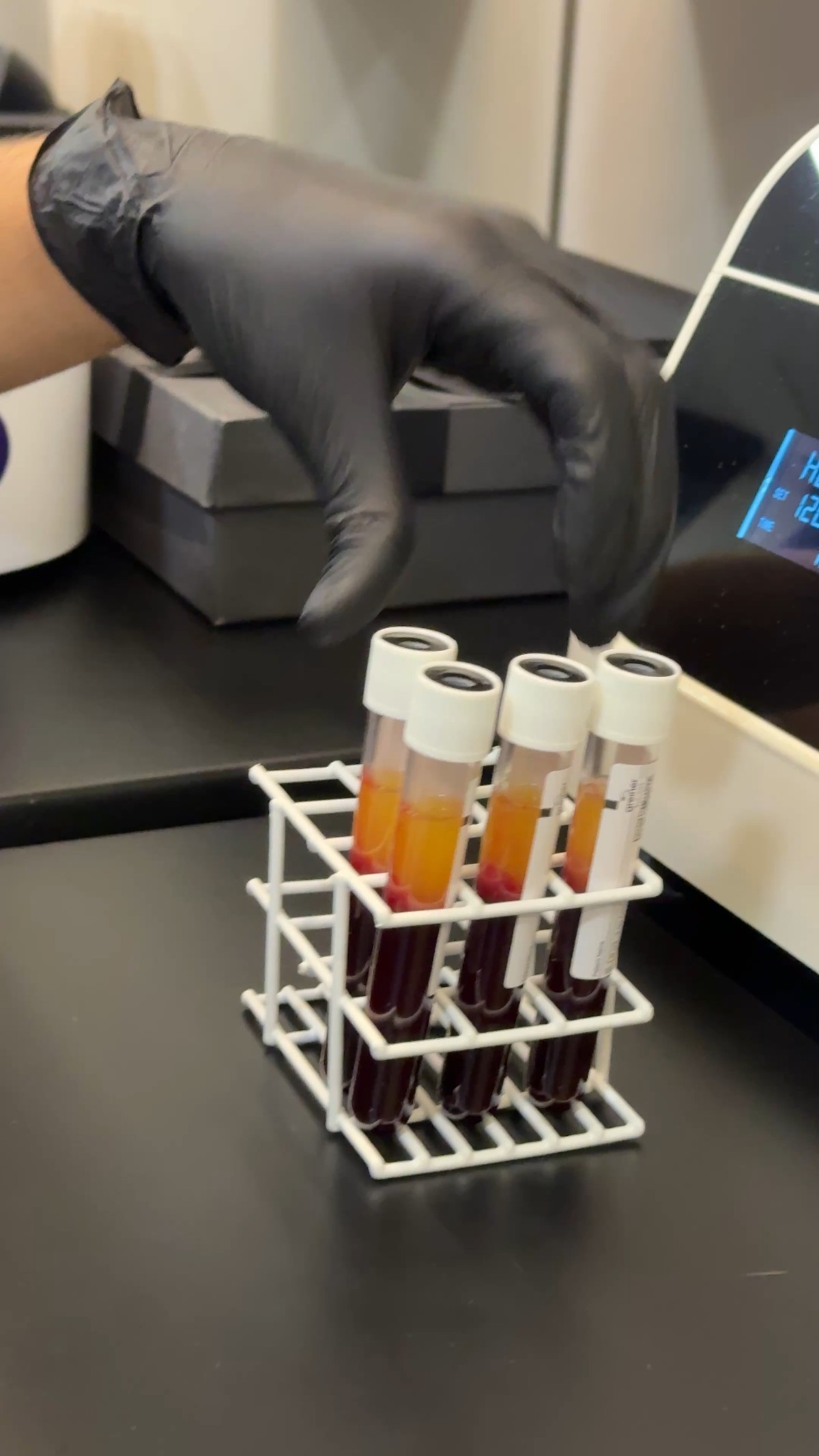 Tubos de i-PRF após centrifugação com separação de plasma dourado e hemácias vermelhas