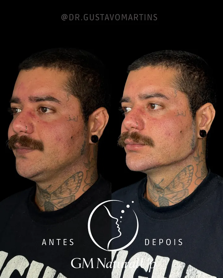 Método NaturalUp® — paciente 6