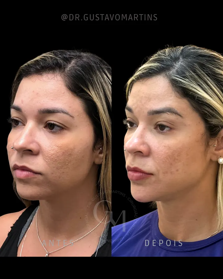 Método NaturalUp® — paciente 7