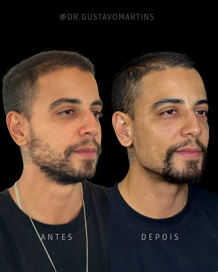 Método NaturalUp® — paciente 8