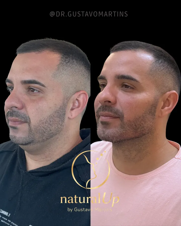 Método NaturalUp® — paciente 9