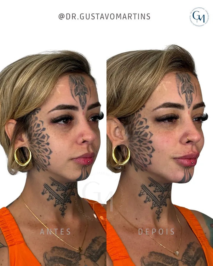 Método NaturalUp® — paciente 16