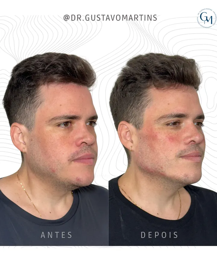 Método NaturalUp® — paciente 19