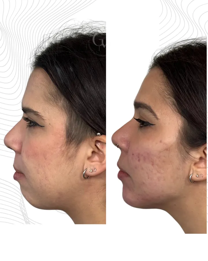 Método NaturalUp® — paciente 24