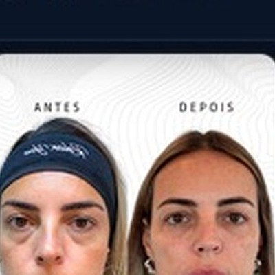 Resultado paciente 1