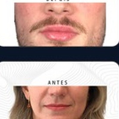 Resultado paciente 10