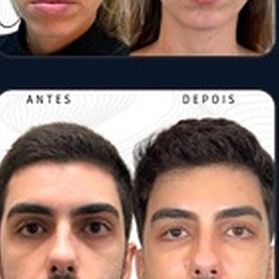 Resultado paciente 4