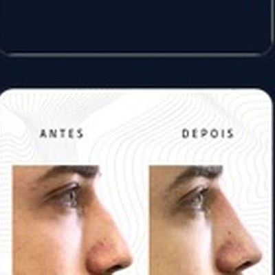 Resultado paciente 5