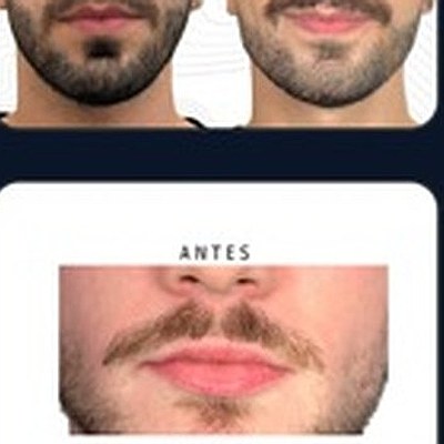 Resultado paciente 7