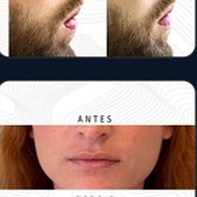 Resultado paciente 8