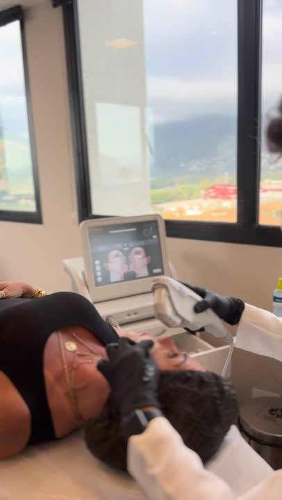 Aplicação do Ultherapy na Clínica Dr. Gustavo Martins